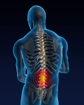 Back Pain FAQs