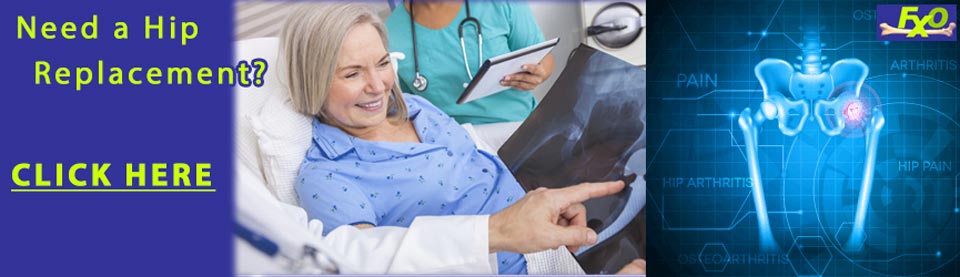 Fairfax, Virginia Hip Replacment Doctors